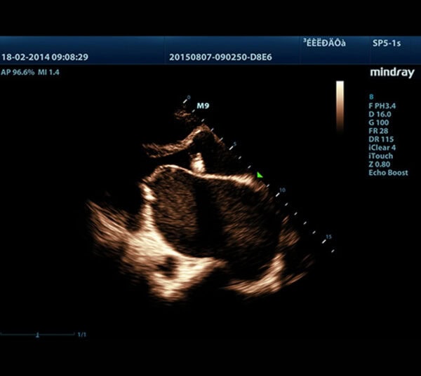 Mindray M9 Ultraschallgerät