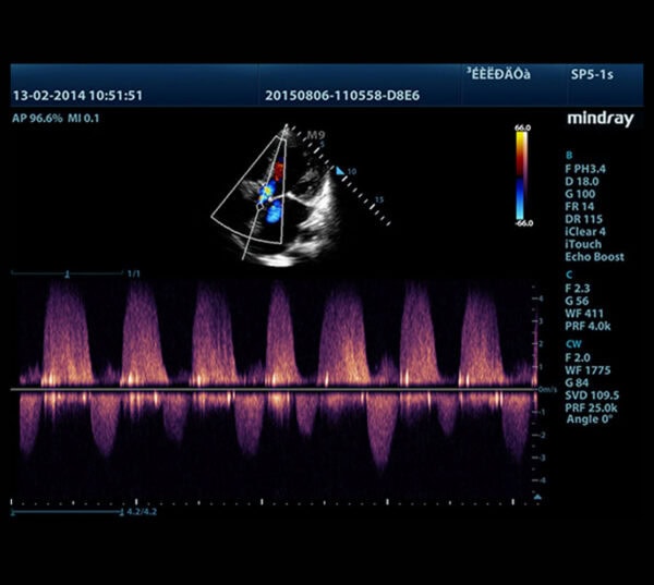 Mindray M9 Ultraschallgerät