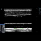 Mindray MX7 Ultraschallgerät