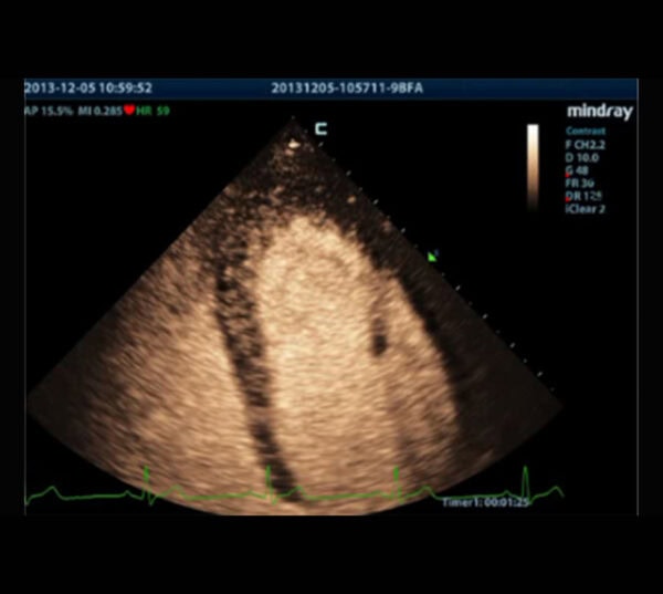 Mindray MX7 Ultraschallgerät