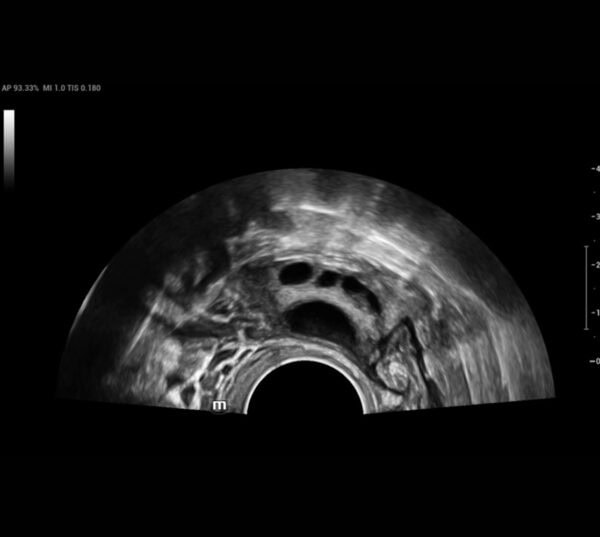 Mindray Nuewa I8 Ultraschallgerät