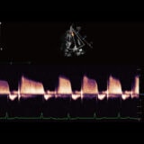 Mindray Resona 7 Ultraschallgerät