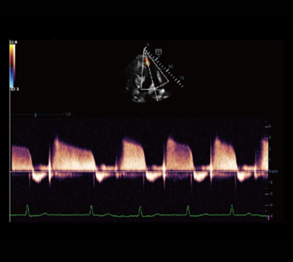 Mindray Resona 7 Ultraschallgerät