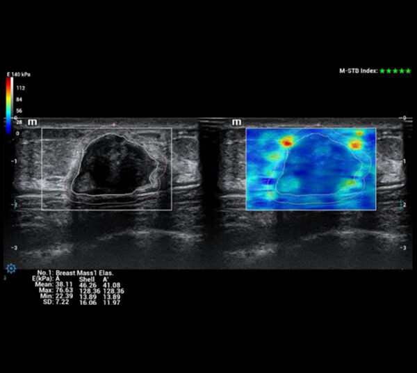 Mindray Resona i8 Ultraschallgerät