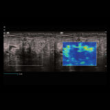 Mindray Resona I9 Ultraschallgerät