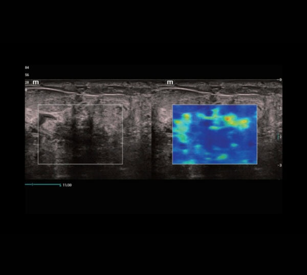 Mindray Resona I9 Ultraschallgerät