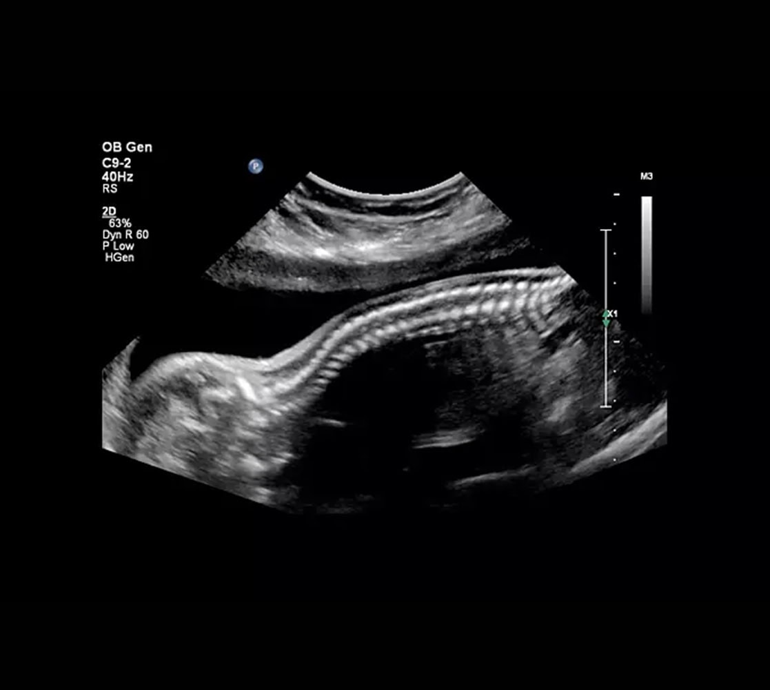 philips-affiniti-70-ultraschallgeraete-2