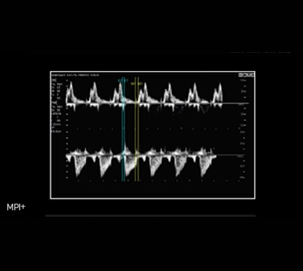 Samsung HERA I10 Ultraschallgerät