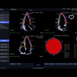 Samsung HM EVO Ultraschallgerät