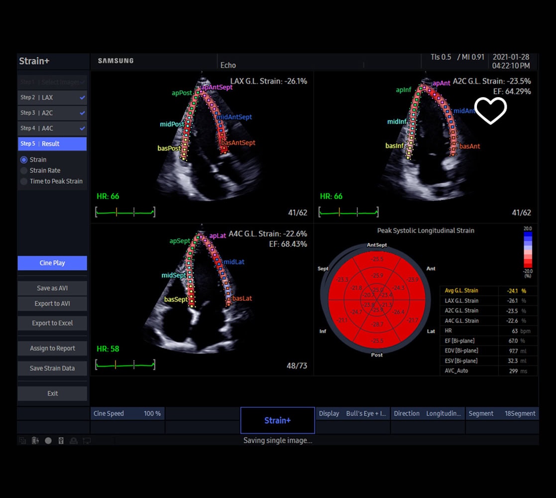 samsung-hera-hm70-evo-ultraschallgeraete-5 Samsung HM EVO Ultraschallgerät