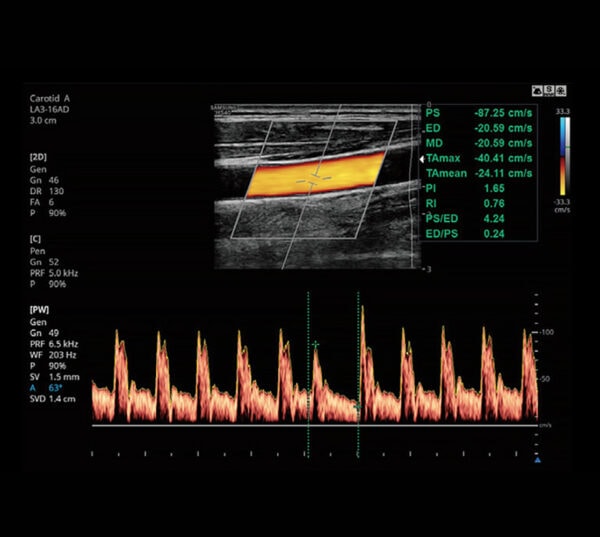 Samsung HS40 Ultraschallgerät