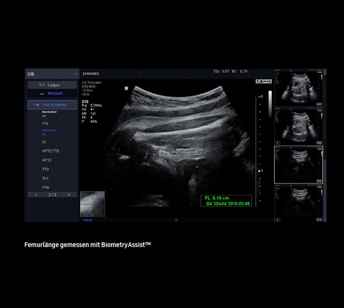 samsung-hera-hs50-ultraschallgeraete-5 Samsung HS50 Ultraschallgerät