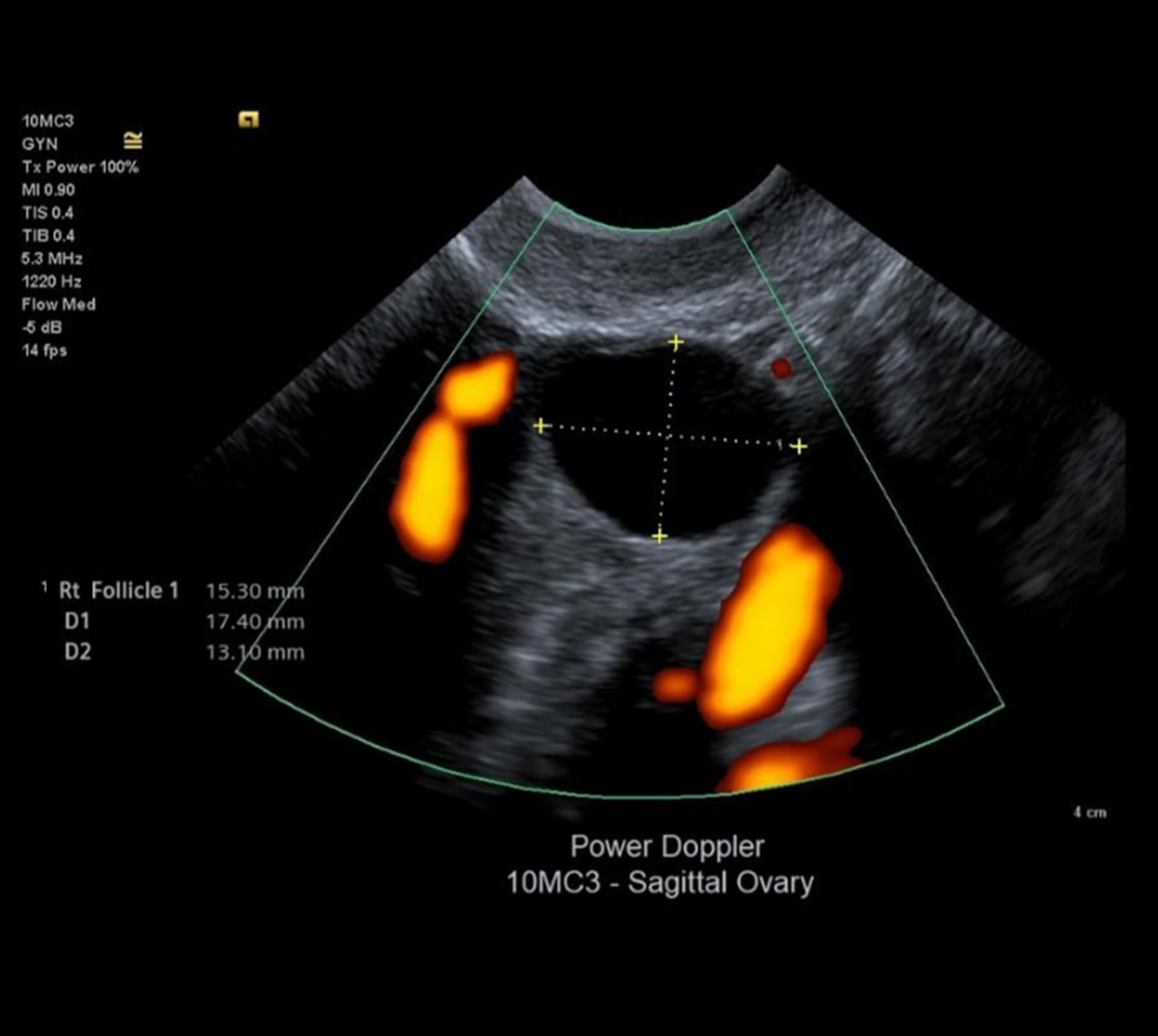 siemens-acuson-juniper-ultraschallgeraete-9