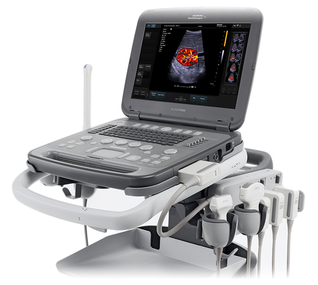 siemens-acuson-ph500-ultraschallgeraete-1 Siemens ACUSON P500 Ultraschallgerät