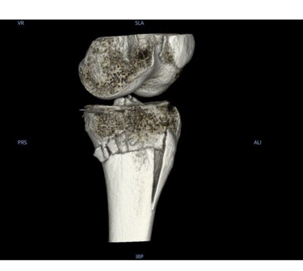 GE HealthCare OEC 3D C-Bogen