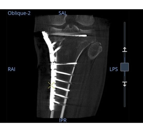 GE HealthCare OEC 3D C-Bogen