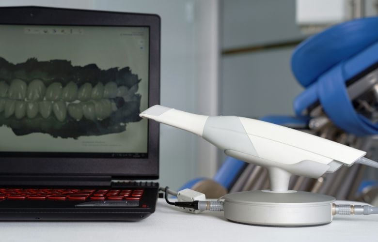 Ein Intraoralscanner (Trios 3 von 3Shape) zur digitalen Zahnerfassung neben einem Bildschirm mit 3D-Zahnmodell