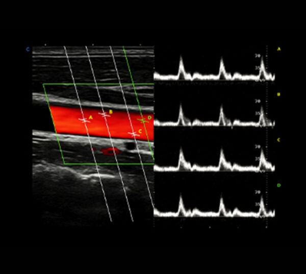 Chison Cbit 10 Ultraschallgerät