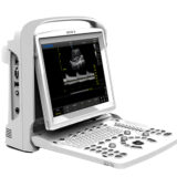 Chison Eco 3 Expert Ultraschallgerät