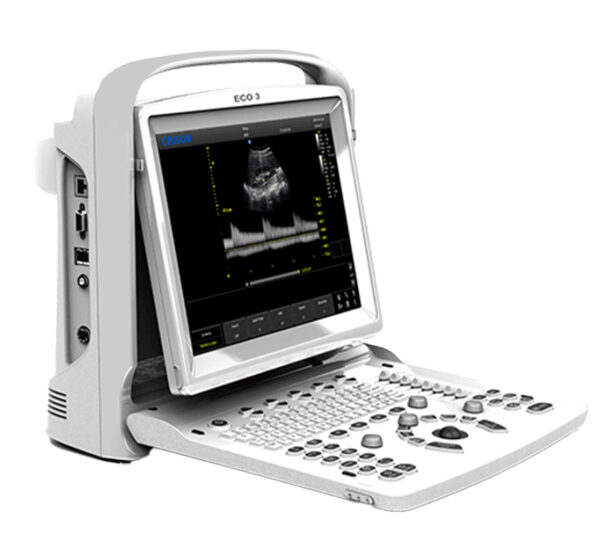 Chison Eco 3 Expert Ultraschallgerät