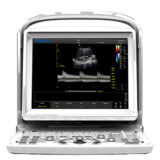 Chison Eco 3 Expert Ultraschallgerät