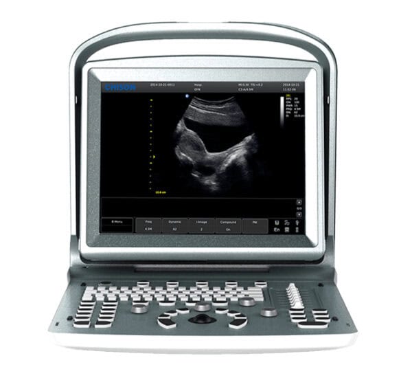 Chison Eco 5 Ultraschallgerät