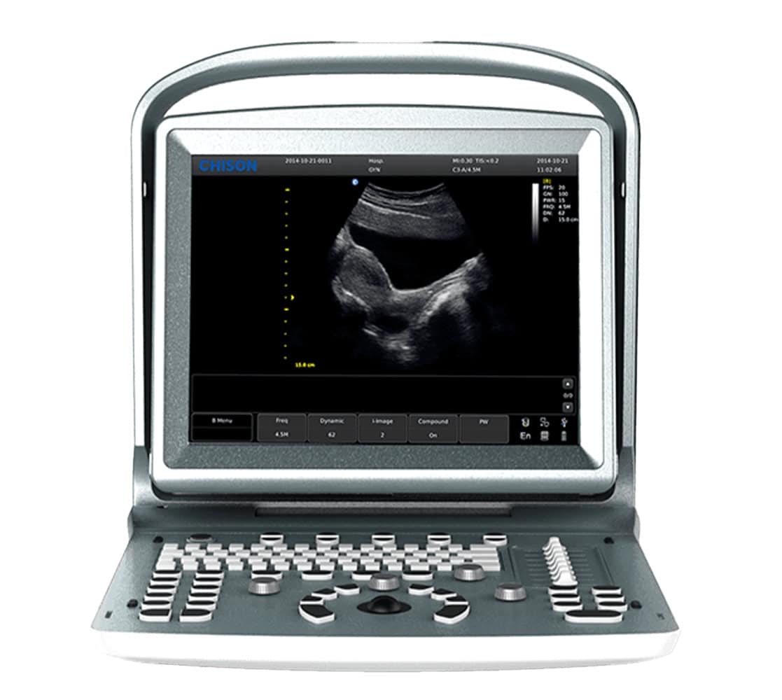 chison-eco-5-ultraschallgeraete Chison Eco 5 Ultraschallgerät