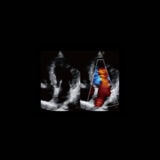 Chison QBit 9 Ultraschallgerät