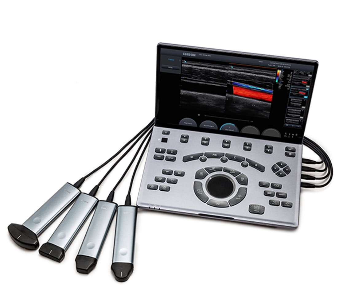 Chison SonoAir 70 Ultraschallgerät