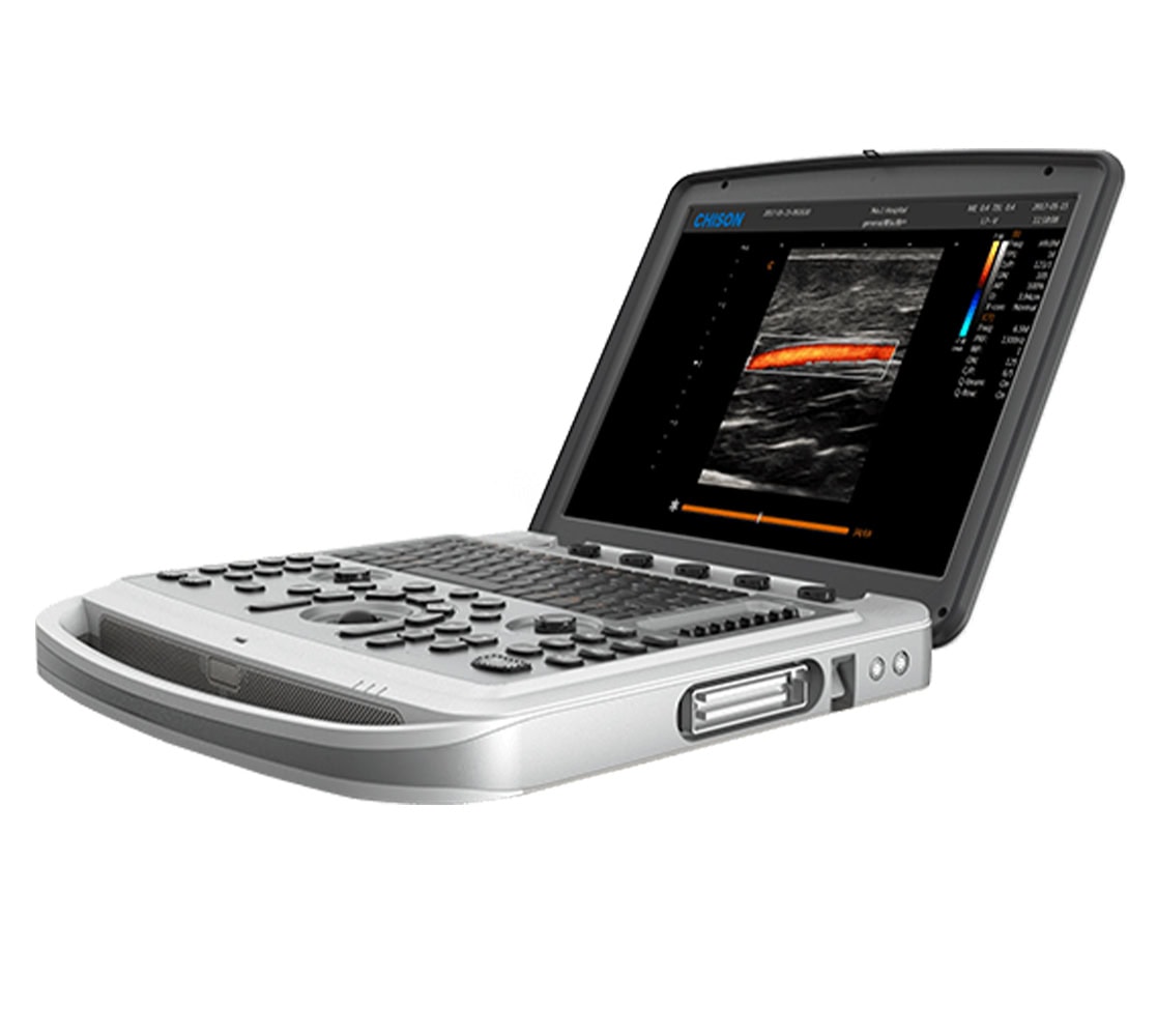 Chison SonoBook 6 Ultraschallgerät