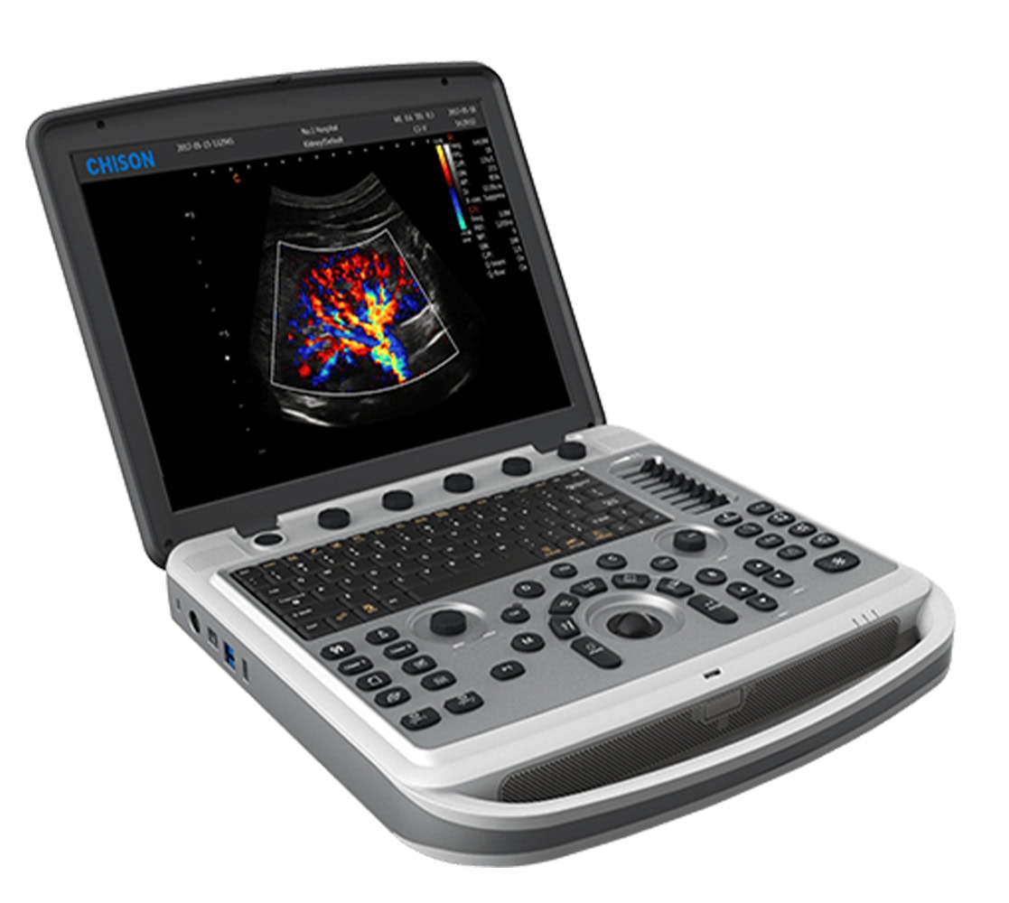 Chison SonoBook 6 Ultraschallgerät