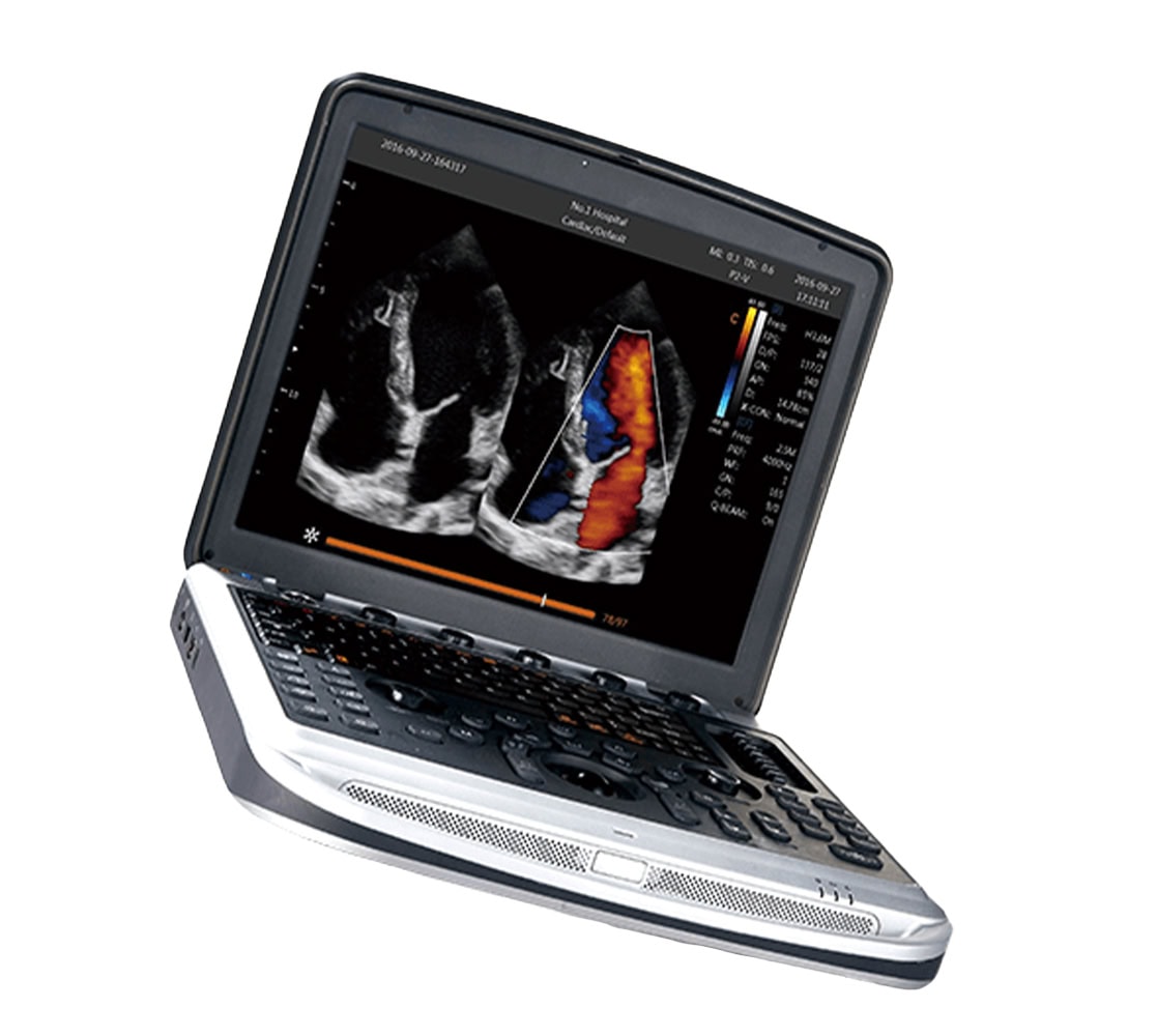 Chison SonoBook 8 Ultraschallgerät