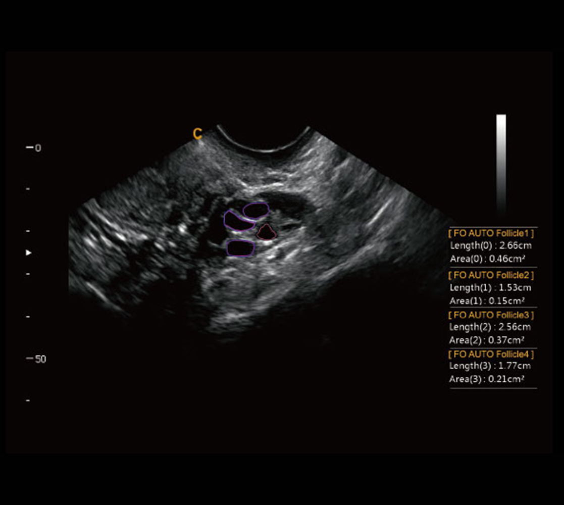 Chison SonoBook 9 Ultraschallgerät