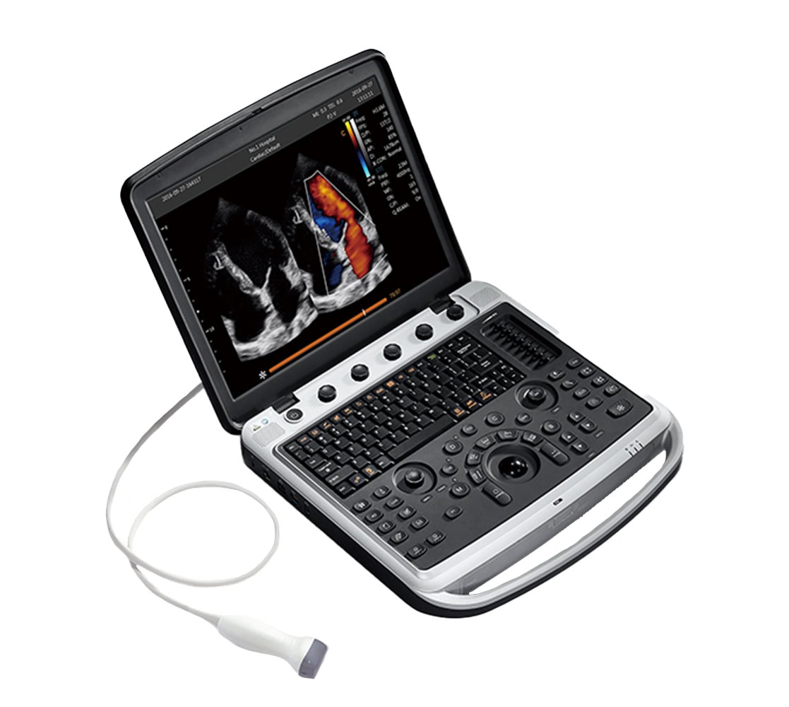 Chison SonoBook 9 Ultraschallgerät