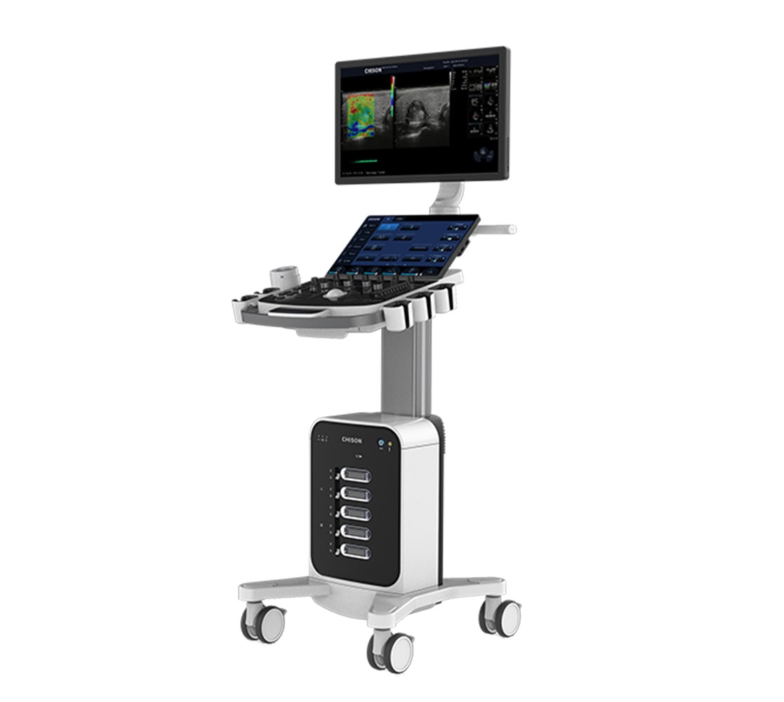 Chison SonoMax 9 Ultraschallgerät