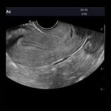 Edan Acclarix AX2 Ultraschallgerät