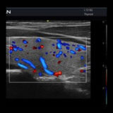 Edan Acclarix AX2 Ultraschallgerät