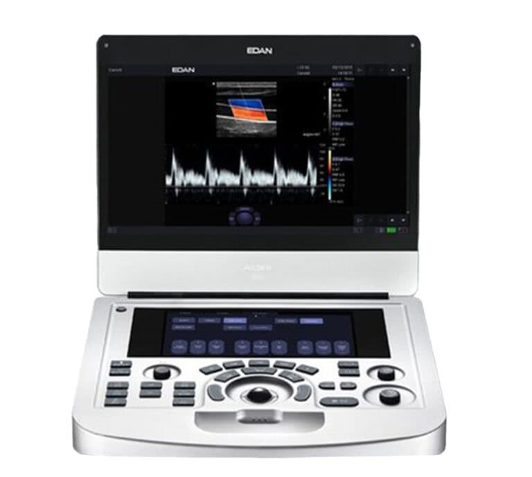 Edan Acclarix AX2 Ultraschallgerät