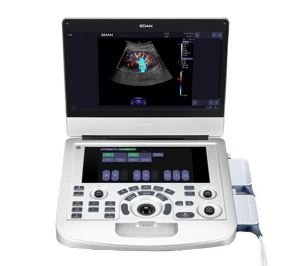 Edan Acclarix AX3 Ultraschallgerät