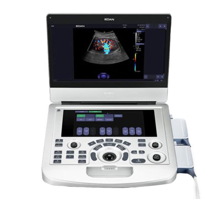Edan Acclarix AX3 Ultraschallgerät