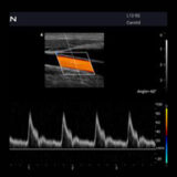 Edan Acclarix AX3 Ultraschallgerät