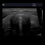 Edan Acclarix AX3 Ultraschallgerät