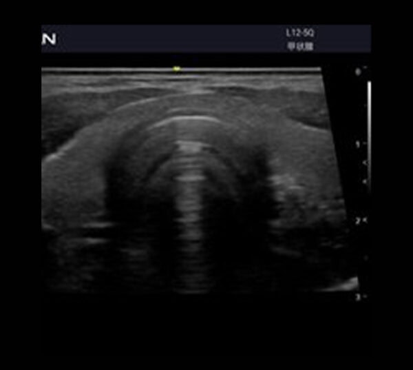 Edan Acclarix AX3 Ultraschallgerät