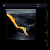 Edan Acclarix AX3 Ultraschallgerät