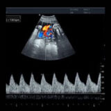 Edan Acclarix AX8 Ultraschallgerät