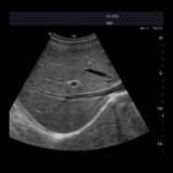 Edan Acclarix AX8 Ultraschallgerät