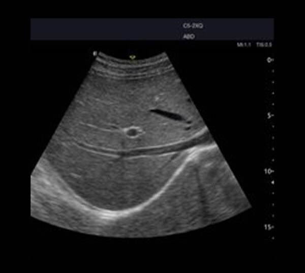 Edan Acclarix AX8 Ultraschallgerät