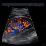 Edan Acclarix AX8 Ultraschallgerät