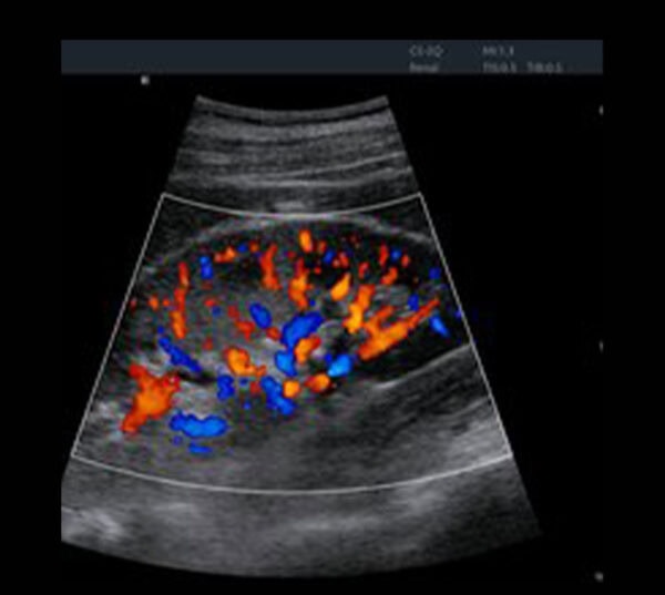 Edan Acclarix AX8 Ultraschallgerät