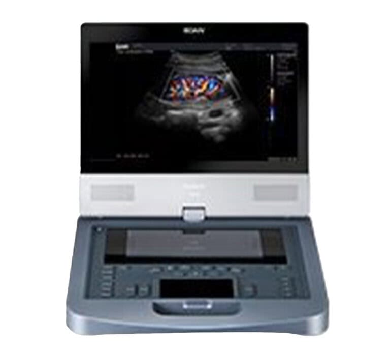 Edan Acclarix AX8 Ultraschallgerät